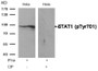 Western blot analysis of extracts from Hela cells, treated with IFNa or calf intestinal phosphatase (CIP), using STAT1 (Phospho-Tyr701) Antibody. Western blot analysis of extracts from Hela cells, treated with IFNa or calf intestinal phosphatase (CIP), using STAT1 (Phospho-Tyr701) Antibody.