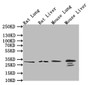 Western Blot, Positive WB detected in: Rat Liver tissue lysate, Rat Lung tissue lysate, Mouse Liver tissue lysate, Mouse Lung tissue lysate, All lanes: CD9 antibody at 1:500, Secondary, Goat polyclonal to rabbit IgG at 1/50000 dilution, Predicted band size: 25 kDa, Observed band size: 25 kDa Western Blot, Positive WB detected in: Rat Liver tissue lysate, Rat Lung tissue lysate, Mouse Liver tissue lysate, Mouse Lung tissue lysate, All lanes: CD9 antibody at 1:500, Secondary, Goat polyclonal to rabbit IgG at 1/50000 dilution, Predicted band size: 25 kDa, Observed band size: 25 kDa