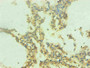 Immunohistochemical of paraffin-embedded human lung tissue using CAC13652 at dilution of 1:200