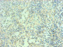 Immunohistochemical of paraffin-embedded human spleen tissue using CAC13652 at dilution of 1:200