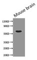 Western Blot, Positive WB detected in: Mouse brain tissue, All lanes: PODXL antibody at 0.43ug/ml, Secondary, Goat polyclonal to Mouse IgG at 1/5000 dilution, Predicted band size: 59, 56 kDa, Observed band size: 59 kDa Western Blot, Positive WB detected in: Mouse brain tissue, All lanes: PODXL antibody at 0.43ug/ml, Secondary, Goat polyclonal to Mouse IgG at 1/5000 dilution, Predicted band size: 59, 56 kDa, Observed band size: 59 kDa