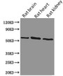 Western Blot, Positive WB detected in: Rat brain tissue, Rat heart tissue, Rat kidney tissue, All lanes: PODXL antibody at 1.28ug/ml, Secondary, Goat polyclonal to Mouse IgG at 1/5000 dilution, Predicted band size: 59, 56 kDa, Observed band size: 59 kDa Western Blot, Positive WB detected in: Rat brain tissue, Rat heart tissue, Rat kidney tissue, All lanes: PODXL antibody at 1.28ug/ml, Secondary, Goat polyclonal to Mouse IgG at 1/5000 dilution, Predicted band size: 59, 56 kDa, Observed band size: 59 kDa