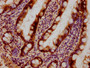 Immunohistochemical of paraffin-embedded human small intestinal tissue using CAC13660 at dilution of 1:100 Immunohistochemical of paraffin-embedded human small intestinal tissue using CAC13660 at dilution of 1:100