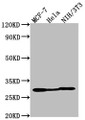 Western Blot, Positive WB detected in: MCF-7 whole cell lysate, Hela whole cell lysate, NIH/3T3 whole cell lysate, All lanes: LGALS3 antibody at 1:2000, Secondary, Goat polyclonal to Mouse IgG at 1/50000 dilution, Predicted band size: 27 kDa, Observed band size: 27 kDa Western Blot, Positive WB detected in: MCF-7 whole cell lysate, Hela whole cell lysate, NIH/3T3 whole cell lysate, All lanes: LGALS3 antibody at 1:2000, Secondary, Goat polyclonal to Mouse IgG at 1/50000 dilution, Predicted band size: 27 kDa, Observed band size: 27 kDa