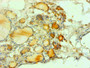 Immunohistochemical of paraffin-embedded human thyroid tissues using CAC13662 at dilution of 1:200