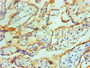 Immunohistochemical of paraffin-embedded Human placenta tissue using CAC13667 at dilution of 1:200. Immunohistochemical of paraffin-embedded Human placenta tissue using CAC13667 at dilution of 1:200.