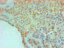 Immunohistochemical of paraffin-embedded Human Breast tissue using CAC13667 at dilution of 1:200. Immunohistochemical of paraffin-embedded Human Breast tissue using CAC13667 at dilution of 1:200.