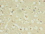 Immunohistochemistry of paraffin-embedded human brain using CAC13674 in 30ug/ml dilute concentrations. Immunohistochemistry of paraffin-embedded human brain using CAC13674 in 30ug/ml dilute concentrations.