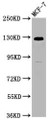 Western Blot, Positive WB detected in: MCF-7 whole cell lysate, All lanes: CD146 antibody at 1:1250, Secondary, Goat polyclonal to Mouse IgG at 1/50000 dilution, Predicted band size: 72, 58 kDa, Observed band size: 120 kDa Western Blot, Positive WB detected in: MCF-7 whole cell lysate, All lanes: CD146 antibody at 1:1250, Secondary, Goat polyclonal to Mouse IgG at 1/50000 dilution, Predicted band size: 72, 58 kDa, Observed band size: 120 kDa