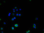 Immunofluorescence staining of A375 cells with CAC13680 at 1:100, counter-stained with DAPI. The cells were blocked in 10% normal Goat Serum and then incubated with the primary antibody overnight at 4°C. The secondary antibody was Alexa Fluor 488-congugated AffiniPure Goat Anti-Mouse IgG(H+L). Immunofluorescence staining of A375 cells with CAC13680 at 1:100, counter-stained with DAPI. The cells were blocked in 10% normal Goat Serum and then incubated with the primary antibody overnight at 4°C. The secondary antibody was Alexa Fluor 488-congugated AffiniPure Goat Anti-Mouse IgG(H+L).