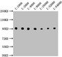 Western Blot, Positive WB detected in: Raji whole cell lysate, All lanes: CD19 antibody at 1:1000, 1:2000, 1:4000, 1:8000, 1:16000, 1:32000, 1:64000, Secondary, Goat polyclonal to Mouse IgG at 1/10000 dilution, Predicted band size: 61 kDa, Observed band size: 95 kDa Western Blot, Positive WB detected in: Raji whole cell lysate, All lanes: CD19 antibody at 1:1000, 1:2000, 1:4000, 1:8000, 1:16000, 1:32000, 1:64000, Secondary, Goat polyclonal to Mouse IgG at 1/10000 dilution, Predicted band size: 61 kDa, Observed band size: 95 kDa