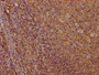 IHC image of CAC13685 diluted at 1:100 and staining in paraffin-embedded human tonsil tissue performed on a Leica BondTM system. After dewaxing and hydration, antigen retrieval was mediated by high pressure in a citrate buffer (pH 6.0). Section was blocked with 10% normal goat serum 30min at RT. Then primary antibody (1% BSA) was incubated at 4°C overnight. The primary is detected by a biotinylated secondary antibody and visualized using an HRP conjugated SP system. IHC image of CAC13685 diluted at 1:100 and staining in paraffin-embedded human tonsil tissue performed on a Leica BondTM system. After dewaxing and hydration, antigen retrieval was mediated by high pressure in a citrate buffer (pH 6.0). Section was blocked with 10% normal goat serum 30min at RT. Then primary antibody (1% BSA) was incubated at 4°C overnight. The primary is detected by a biotinylated secondary antibody and visualized using an HRP conjugated SP system.