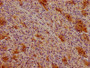 IHC image of CAC13685 diluted at 1:100 and staining in paraffin-embedded human spleen tissue performed on a Leica BondTM system. After dewaxing and hydration, antigen retrieval was mediated by high pressure in a citrate buffer (pH 6.0). Section was blocked with 10% normal goat serum 30min at RT. Then primary antibody (1% BSA) was incubated at 4°C overnight. The primary is detected by a biotinylated secondary antibody and visualized using an HRP conjugated SP system. IHC image of CAC13685 diluted at 1:100 and staining in paraffin-embedded human spleen tissue performed on a Leica BondTM system. After dewaxing and hydration, antigen retrieval was mediated by high pressure in a citrate buffer (pH 6.0). Section was blocked with 10% normal goat serum 30min at RT. Then primary antibody (1% BSA) was incubated at 4°C overnight. The primary is detected by a biotinylated secondary antibody and visualized using an HRP conjugated SP system.