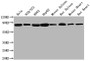 Western Blot, Positive WB detected in: Hela whole cell lysate, NIH/3T3 whole cell lysate, K562 whole cell lysate, HepG2 whole cell lysate, Mouse spleen tissue, Rat spleen tissue, Mouse heart tissue, Rat heart tissue , All lanes HSPA8 antibody at 1:2000, Secondary, Goat polyclonal to mouse IgG at 1/50000 dilution, Predicted band size: 70~75 KDa, Observed band size: 70~75 KDa, Exposure time: 10s Western Blot, Positive WB detected in: Hela whole cell lysate, NIH/3T3 whole cell lysate, K562 whole cell lysate, HepG2 whole cell lysate, Mouse spleen tissue, Rat spleen tissue, Mouse heart tissue, Rat heart tissue , All lanes HSPA8 antibody at 1:2000, Secondary, Goat polyclonal to mouse IgG at 1/50000 dilution, Predicted band size: 70~75 KDa, Observed band size: 70~75 KDa, Exposure time: 10s