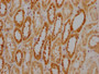 IHC image of CAC13690 diluted at 1:220 and staining in paraffin-embedded human kidney tissue performed on a Leica BondTM system. After dewaxing and hydration, antigen retrieval was mediated by high pressure in a citrate buffer (pH 6.0). Section was blocked with 10% normal goat serum 30min at RT. Then primary antibody (1% BSA) was incubated at 4°C overnight. The primary is detected by a biotinylated secondary antibody and visualized using an HRP conjugated SP system. IHC image of CAC13690 diluted at 1:220 and staining in paraffin-embedded human kidney tissue performed on a Leica BondTM system. After dewaxing and hydration, antigen retrieval was mediated by high pressure in a citrate buffer (pH 6.0). Section was blocked with 10% normal goat serum 30min at RT. Then primary antibody (1% BSA) was incubated at 4°C overnight. The primary is detected by a biotinylated secondary antibody and visualized using an HRP conjugated SP system.