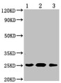 Western Blot, Positive WB detected in: 1.Exosomes extracted from plasma 2.Exosomes extracted from serum 3.Exosomes extracted from Hela cells, Exosomes extracted from serum, All lanes: CD9 antibody at 1:1000, Secondary, Goat polyclonal to mouse IgG at 1/50000 dilution, Predicted band size: 25 KDa, Observed band size: 25 KDa, Exposure time: 5min Western Blot, Positive WB detected in: 1.Exosomes extracted from plasma 2.Exosomes extracted from serum 3.Exosomes extracted from Hela cells, Exosomes extracted from serum, All lanes: CD9 antibody at 1:1000, Secondary, Goat polyclonal to mouse IgG at 1/50000 dilution, Predicted band size: 25 KDa, Observed band size: 25 KDa, Exposure time: 5min