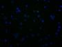 Immunofluorescence staining of JK cells with CAC13700 at 1:100, counter-stained with DAPI. The cells were fixed in 4% formaldehyde and blocked in 10% normal Goat Serum. The cells were incubated with the antibody overnight at 4°C. Nuclear DNA was labeled in blue with DAPI. The secondary antibody was FITC-conjugated AffiniPure Goat Anti-Mouse IgG (H+L). Immunofluorescence staining of JK cells with CAC13700 at 1:100, counter-stained with DAPI. The cells were fixed in 4% formaldehyde and blocked in 10% normal Goat Serum. The cells were incubated with the antibody overnight at 4°C. Nuclear DNA was labeled in blue with DAPI. The secondary antibody was FITC-conjugated AffiniPure Goat Anti-Mouse IgG (H+L).