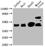 Western Blot, Positive WB detected in: Jurkat whole cell lysate, Raji whole cell lysate, Daudi whole cell lysate, Mouse liver tissue , All lanes: CD48 antibody at 1:2000, Secondary, Goat polyclonal to mouse IgG at 1/50000 dilution, Predicted band size: 28, 20 KDa, Observed band size: 43 KDa, Exposure time:5min Western Blot, Positive WB detected in: Jurkat whole cell lysate, Raji whole cell lysate, Daudi whole cell lysate, Mouse liver tissue , All lanes: CD48 antibody at 1:2000, Secondary, Goat polyclonal to mouse IgG at 1/50000 dilution, Predicted band size: 28, 20 KDa, Observed band size: 43 KDa, Exposure time:5min