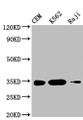 Western Blot, Positive WB detected in: CEM whole cell lysate, K562 whole cell lysate, Raji whole cell lysate , All lanes: CTLA4 antibody at 1:1000, Secondary, Goat polyclonal to mouse IgG at 1/50000 dilution, Predicted band size: 25, 7, 9, 20 KDa, Observed band size: 34 KDa, Exposure time:5min Western Blot, Positive WB detected in: CEM whole cell lysate, K562 whole cell lysate, Raji whole cell lysate , All lanes: CTLA4 antibody at 1:1000, Secondary, Goat polyclonal to mouse IgG at 1/50000 dilution, Predicted band size: 25, 7, 9, 20 KDa, Observed band size: 34 KDa, Exposure time:5min
