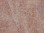 IHC image of CAC13702 diluted at 1:500 and staining in paraffin-embedded human tonsil tissue performed on a Leica BondTM system. After dewaxing and hydration, antigen retrieval was mediated by high pressure in a citrate buffer (pH 6.0). Section was blocked with 10% normal goat serum 30min at 37℃ Then primary antibody (1% BSA) was incubated at 4°C overnight. The primary is detected by a Goat anti-Mouse IgG labeled by HRP and visualized using 0.05% DAB. IHC image of CAC13702 diluted at 1:500 and staining in paraffin-embedded human tonsil tissue performed on a Leica BondTM system. After dewaxing and hydration, antigen retrieval was mediated by high pressure in a citrate buffer (pH 6.0). Section was blocked with 10% normal goat serum 30min at 37℃ Then primary antibody (1% BSA) was incubated at 4°C overnight. The primary is detected by a Goat anti-Mouse IgG labeled by HRP and visualized using 0.05% DAB.