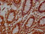 IHC image of CAC13703 diluted at 1:100 and staining in paraffin-embedded human colon tissue performed on a Leica BondTM system. After dewaxing and hydration, antigen retrieval was mediated by high pressure in a citrate buffer (pH 6.0). Section was blocked with 10% normal goat serum 30min at 37℃ Then primary antibody (1% BSA) was incubated at 4°C overnight. The primary is detected by a Goat anti-Mouse IgG labeled by HRP and visualized using 0.05% DAB. IHC image of CAC13703 diluted at 1:100 and staining in paraffin-embedded human colon tissue performed on a Leica BondTM system. After dewaxing and hydration, antigen retrieval was mediated by high pressure in a citrate buffer (pH 6.0). Section was blocked with 10% normal goat serum 30min at 37℃ Then primary antibody (1% BSA) was incubated at 4°C overnight. The primary is detected by a Goat anti-Mouse IgG labeled by HRP and visualized using 0.05% DAB.