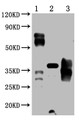 Western Blot Positive WB detected in: 5ug 293 whole cell lysate transfected with PD-1, 25ng recombinant protein from E.coli, 25ng recombinant protein from Mammalian cell PD-1 antibody at 1:1000 Secondary Goat polyclonal to mouse IgG at 1/50000 dilution Predicted band size: 72, 36 KDa Observed band size: 72, 36 KDa Exposure time: 5min