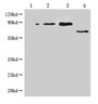 Western Blot, Positive WB detected in: 1-3 lanes: Recombinant Enterobacteria phage M13 Attachment protein at 5ng, 10ng, 20ng; 4 lane: Enterobacteria phage M13 Attachment, All lanes: Enterobacteria phage M13 III antibody at 1:1000, Secondary, Goat polyclonal to mouse IgG at 1/50000 dilution, Predicted band size: 65, 55-70 KDa, Observed band size: 65, 55-70 KDa, Exposure time:3min Western Blot, Positive WB detected in: 1-3 lanes: Recombinant Enterobacteria phage M13 Attachment protein at 5ng, 10ng, 20ng; 4 lane: Enterobacteria phage M13 Attachment, All lanes: Enterobacteria phage M13 III antibody at 1:1000, Secondary, Goat polyclonal to mouse IgG at 1/50000 dilution, Predicted band size: 65, 55-70 KDa, Observed band size: 65, 55-70 KDa, Exposure time:3min
