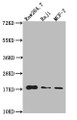 Western Blot Positive WB detected in: Raw264.7 whole cell lysate, Raji whole cell lysate, MCF-7 whole cell lysate All lanes: HistoneH3 antibody at 1:20000 Secondary Goat polyclonal to mouse IgG at 1/50000 dilution Predicted band size: 15-25 KDa Observed band size: 15-25 KDa Exposure time: 1min Western Blot Positive WB detected in: Raw264.7 whole cell lysate, Raji whole cell lysate, MCF-7 whole cell lysate All lanes: HistoneH3 antibody at 1:20000 Secondary Goat polyclonal to mouse IgG at 1/50000 dilution Predicted band size: 15-25 KDa Observed band size: 15-25 KDa Exposure time: 1min