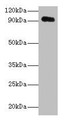 Western Blot, All lanes: APP antibody at 2ug/ml + HL60 whole cell lysate, Secondary, Goat polyclonal to rabbit IgG at 1/10000 dilution, Predicted band size: 87, 35, 77, 79, 81, 83, 85, 86, 73 kDa, Observed band size: 95 kDa Western Blot, All lanes: APP antibody at 2ug/ml + HL60 whole cell lysate, Secondary, Goat polyclonal to rabbit IgG at 1/10000 dilution, Predicted band size: 87, 35, 77, 79, 81, 83, 85, 86, 73 kDa, Observed band size: 95 kDa
