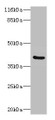Western Blot, All lanes: CA12 antibody at 2ug/ml + Mouse kidney tissue, Secondary, Goat polyclonal to rabbit IgG at 1/10000 dilution, Predicted band size: 40, 39 kDa, Observed band size: 40 kDa Western Blot, All lanes: CA12 antibody at 2ug/ml + Mouse kidney tissue, Secondary, Goat polyclonal to rabbit IgG at 1/10000 dilution, Predicted band size: 40, 39 kDa, Observed band size: 40 kDa