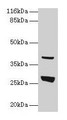 Western Blot, All lanes: Gamt antibody at 2ug/ml + Rat liver tissue, Secondary, Goat polyclonal to rabbit IgG at 1/10000 dilution, Predicted band size: 27 kDa, Observed band size: 27 kDa Western Blot, All lanes: Gamt antibody at 2ug/ml + Rat liver tissue, Secondary, Goat polyclonal to rabbit IgG at 1/10000 dilution, Predicted band size: 27 kDa, Observed band size: 27 kDa