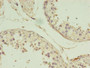 Immunohistochemistry of paraffin-embedded human testis tissue using CAC13739 at dilution of 1:100 Immunohistochemistry of paraffin-embedded human testis tissue using CAC13739 at dilution of 1:100