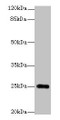 Western Blot, All lanes: GOSR2 antibody at 4ug/ml + Jurkat whole cell lysate, Secondary, Goat polyclonal to rabbit IgG at 1/10000 dilution, Predicted band size: 25, 23 kDa, Observed band size: 25 kDa