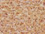 IHC image of CAC13746 diluted at 1:250 and staining in paraffin-embedded human liver tissue performed on a Leica BondTM system. After dewaxing and hydration, antigen retrieval was mediated by high pressure in a citrate buffer (pH 6.0). Section was blocked with 10% normal goat serum 30min at RT. Then primary antibody (1% BSA) was incubated at 4°C overnight. The primary is detected by a biotinylated secondary antibody and visualized using an HRP conjugated SP system.