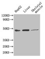 Western Blot, Positive WB detected in: HepG2 whole cell lysate, Mouse liver tissue, Mouse skeletal muscle tissue, All lanes: GOT1 antibody at 4.5ug/ml, Secondary, Goat polyclonal to rabbit IgG at 1/50000 dilution, Predicted band size: 47, 45 kDa, Observed band size: 47 kDa