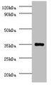 Western Blot, All lanes: Serine/threonine-protein phosphatase 2A catalytic subunit beta isoform Antibody at 2ug/ml + EC109 whole cell lysate, Secondary, Goat polyclonal to rabbit IgG at 1/15000 dilution, Predicted band size: 34 kDa, Observed band size: 34 kDa Western Blot, All lanes: Serine/threonine-protein phosphatase 2A catalytic subunit beta isoform Antibody at 2ug/ml + EC109 whole cell lysate, Secondary, Goat polyclonal to rabbit IgG at 1/15000 dilution, Predicted band size: 34 kDa, Observed band size: 34 kDa