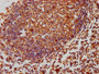 IHC image of CAC13748 diluted at 1:260 and staining in paraffin-embedded human lymph node tissue performed on a Leica BondTM system. After dewaxing and hydration, antigen retrieval was mediated by high pressure in a citrate buffer (pH 6.0). Section was blocked with 10% normal goat serum 30min at RT. Then primary antibody (1% BSA) was incubated at 4°C overnight. The primary is detected by a biotinylated secondary antibody and visualized using an HRP conjugated SP system. IHC image of CAC13748 diluted at 1:260 and staining in paraffin-embedded human lymph node tissue performed on a Leica BondTM system. After dewaxing and hydration, antigen retrieval was mediated by high pressure in a citrate buffer (pH 6.0). Section was blocked with 10% normal goat serum 30min at RT. Then primary antibody (1% BSA) was incubated at 4°C overnight. The primary is detected by a biotinylated secondary antibody and visualized using an HRP conjugated SP system.