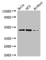 Western Blot, Positive WB detected in: Hela whole cell lysate, PC-3 whole cell lysate, Mouse kidney tissue, All lanes: GSK3B antibody at 3ug/ml, Secondary, Goat polyclonal to rabbit IgG at 1/50000 dilution, Predicted band size: 47, 49 kDa, Observed band size: 47 kDa Western Blot, Positive WB detected in: Hela whole cell lysate, PC-3 whole cell lysate, Mouse kidney tissue, All lanes: GSK3B antibody at 3ug/ml, Secondary, Goat polyclonal to rabbit IgG at 1/50000 dilution, Predicted band size: 47, 49 kDa, Observed band size: 47 kDa