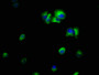 Immunofluorescence staining of MCF-7 cells with CAC13754 at 1:66, counter-stained with DAPI. The cells were fixed in 4% formaldehyde, permeabilized using 0.2% Triton X-100 and blocked in 10% normal Goat Serum. The cells were then incubated with the antibody overnight at 4°C. The secondary antibody was Alexa Fluor 488-congugated AffiniPure Goat Anti-Rabbit IgG(H+L). Immunofluorescence staining of MCF-7 cells with CAC13754 at 1:66, counter-stained with DAPI. The cells were fixed in 4% formaldehyde, permeabilized using 0.2% Triton X-100 and blocked in 10% normal Goat Serum. The cells were then incubated with the antibody overnight at 4°C. The secondary antibody was Alexa Fluor 488-congugated AffiniPure Goat Anti-Rabbit IgG(H+L).