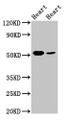 Western Blot, Positive WB detected in: Rat heart tissue, Mouse heart tissue, All lanes: ILK antibody at 5ug/ml, Secondary, Goat polyclonal to rabbit IgG at 1/50000 dilution, Predicted band size: 52, 45, 37 kDa, Observed band size: 52 kDa Western Blot, Positive WB detected in: Rat heart tissue, Mouse heart tissue, All lanes: ILK antibody at 5ug/ml, Secondary, Goat polyclonal to rabbit IgG at 1/50000 dilution, Predicted band size: 52, 45, 37 kDa, Observed band size: 52 kDa