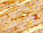IHC image of CAC13754 diluted at 1:100 and staining in paraffin-embedded human skeletal muscle tissue performed on a Leica BondTM system. After dewaxing and hydration, antigen retrieval was mediated by high pressure in a citrate buffer (pH 6.0). Section was blocked with 10% normal goat serum 30min at RT. Then primary antibody (1% BSA) was incubated at 4°C overnight. The primary is detected by a biotinylated secondary antibody and visualized using an HRP conjugated SP system. IHC image of CAC13754 diluted at 1:100 and staining in paraffin-embedded human skeletal muscle tissue performed on a Leica BondTM system. After dewaxing and hydration, antigen retrieval was mediated by high pressure in a citrate buffer (pH 6.0). Section was blocked with 10% normal goat serum 30min at RT. Then primary antibody (1% BSA) was incubated at 4°C overnight. The primary is detected by a biotinylated secondary antibody and visualized using an HRP conjugated SP system.