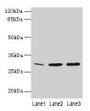 Western Blot, All lanes: GTF2F2 antibody at 16ug/ml, Lane 1: Mouse spleen tissue, Lane 2: K562 whole cell lysate, Lane 3: A549 whole cell lysate, Secondary, Goat polyclonal to rabbit IgG at 1/10000 dilution, Predicted band size: 29 kDa, Observed band size: 29 kDa Western Blot, All lanes: GTF2F2 antibody at 16ug/ml, Lane 1: Mouse spleen tissue, Lane 2: K562 whole cell lysate, Lane 3: A549 whole cell lysate, Secondary, Goat polyclonal to rabbit IgG at 1/10000 dilution, Predicted band size: 29 kDa, Observed band size: 29 kDa