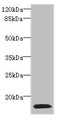 Western Blot, All lanes: HIST1H2AG antibody at 4ug/ml + HL60 whole cell lysate, Secondary, Goat polyclonal to rabbit IgG at 1/10000 dilution, Predicted band size: 15 kDa, Observed band size: 15 kDa Western Blot, All lanes: HIST1H2AG antibody at 4ug/ml + HL60 whole cell lysate, Secondary, Goat polyclonal to rabbit IgG at 1/10000 dilution, Predicted band size: 15 kDa, Observed band size: 15 kDa