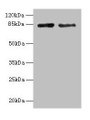 Western Blot, All lanes: HJURP antibody at 12ug/ml, Lane 1: Jurkat whole cell lysate, Lane 2: Hela whole cell lysate, Secondary, Goat polyclonal to rabbit IgG at 1/10000 dilution, Predicted band size: 84, 78, 75 kDa, Observed band size: 84 kDa Western Blot, All lanes: HJURP antibody at 12ug/ml, Lane 1: Jurkat whole cell lysate, Lane 2: Hela whole cell lysate, Secondary, Goat polyclonal to rabbit IgG at 1/10000 dilution, Predicted band size: 84, 78, 75 kDa, Observed band size: 84 kDa