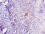 Immunohistochemistry of paraffin-embedded human tonsil tissue using CAC13777 at dilution of 1:10 Immunohistochemistry of paraffin-embedded human tonsil tissue using CAC13777 at dilution of 1:10