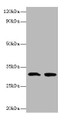 Western Blot, All lanes: IL1B antibody at 2ug/ml, Lane 1: Recombinant Interleukin-1 beta protein 0.05ug, Lane 2: Recombinant Interleukin-1 beta protein 0.5ug, Secondary, Goat polyclonal to rabbit IgG at 1/10000 dilution, Predicted band size: 31 kDa, Observed band size: 31 kDa Western Blot, All lanes: IL1B antibody at 2ug/ml, Lane 1: Recombinant Interleukin-1 beta protein 0.05ug, Lane 2: Recombinant Interleukin-1 beta protein 0.5ug, Secondary, Goat polyclonal to rabbit IgG at 1/10000 dilution, Predicted band size: 31 kDa, Observed band size: 31 kDa