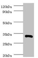 Western Blot, All lanes: IL1B antibody at 2ug/ml + Recombinant Interleukin-1 beta protein 0.01ug, Secondary, Goat polyclonal to rabbit IgG at 1/10000 dilution, Predicted band size: 31 kDa, Observed band size: 31 kDa Western Blot, All lanes: IL1B antibody at 2ug/ml + Recombinant Interleukin-1 beta protein 0.01ug, Secondary, Goat polyclonal to rabbit IgG at 1/10000 dilution, Predicted band size: 31 kDa, Observed band size: 31 kDa