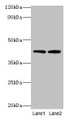 Western Blot, All lanes: LIAS antibody at 2ug/ml, Lane 1: MCF-7 whole cell lysate, Lane 2: K562 whole cell lysate, Secondary, Goat polyclonal to rabbit IgG at 1/10000 dilution, Predicted band size: 42, 37, 38 kDa, Observed band size: 42 kDa Western Blot, All lanes: LIAS antibody at 2ug/ml, Lane 1: MCF-7 whole cell lysate, Lane 2: K562 whole cell lysate, Secondary, Goat polyclonal to rabbit IgG at 1/10000 dilution, Predicted band size: 42, 37, 38 kDa, Observed band size: 42 kDa