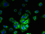Immunofluorescent analysis of MCF-7 cells using CAC13803 at dilution of 1:100 and Alexa Fluor 488-congugated AffiniPure Goat Anti-Rabbit IgG(H+L) Immunofluorescent analysis of MCF-7 cells using CAC13803 at dilution of 1:100 and Alexa Fluor 488-congugated AffiniPure Goat Anti-Rabbit IgG(H+L)