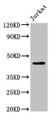 Western Blot, Positive WB detected in: Jurkat whole cell lysate, All lanes: LPXN antibody at 2ug/ml, Secondary, Goat polyclonal to rabbit IgG at 1/50000 dilution, Predicted band size: 44 kDa, Observed band size: 44 kDa Western Blot, Positive WB detected in: Jurkat whole cell lysate, All lanes: LPXN antibody at 2ug/ml, Secondary, Goat polyclonal to rabbit IgG at 1/50000 dilution, Predicted band size: 44 kDa, Observed band size: 44 kDa